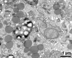 vegetative cytoplasm with organells; sperm cell (right)