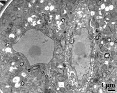 vegetative nucleus and generative cell (right)