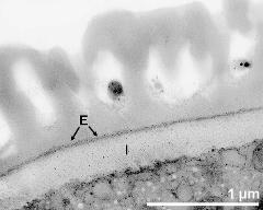 apertural area of pollen wall