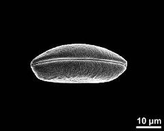 dry pollen grain in polar view (distal)