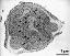 mature pollen grain with vegetative nucleus and generative cell; note p-particle accumulation at the apertures