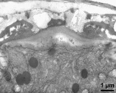 apertural area of pollen wall