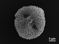 Equatorial view of the acetolyzed pollen