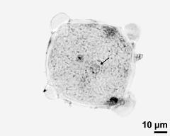 pollen grain with vegetative nucleus (asterisk) and generative cell (arrow)