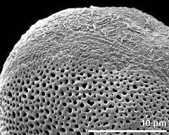 sulcus border