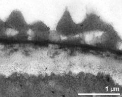 pollen wall, interapertural area