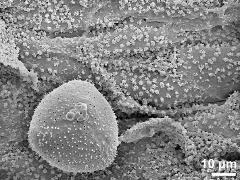 locular wall with Ubisch bodies and pollen grain (polar view)