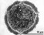 pollen grain in cross section